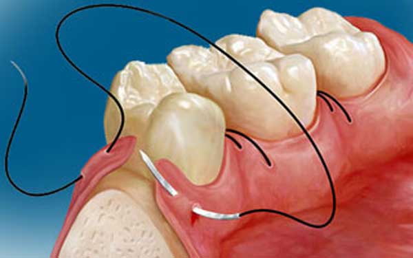 oral surgery